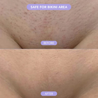 🆙✨2-in-1 Painless Bikini Hair Trimmer for Face & Body