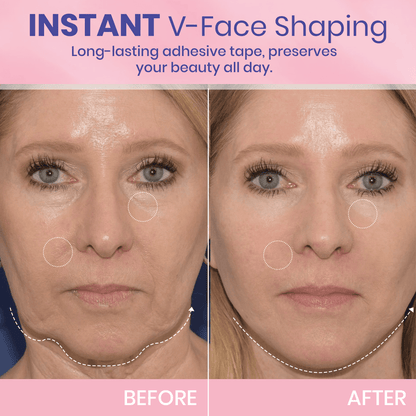 ✨ V-Face Lifting Tape🪄– Instant Jawline Lift & Slim Look