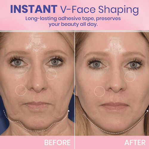 ✨ V-Face Lifting Tape🪄– Instant Jawline Lift & Slim Look