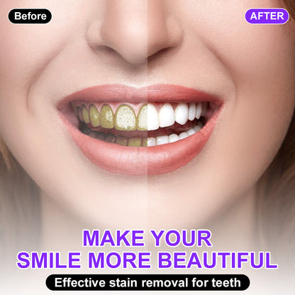 💚💚𝐅𝐥𝐲𝐬𝐦𝐮𝐬®🦷 𝐂𝐨𝐥𝐨𝐮𝐫 𝐂𝐨𝐫𝐫𝐞𝐜𝐭𝐨𝐫 𝐒𝐞𝐫𝐮𝐦 — Clinically proven to gently remove stains, whiten teeth, and restore natural brightness in just 3 days — safe for sensitive teeth and enamel