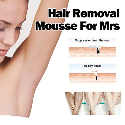 🆙✨Rolimey®Gentle Hair Removal Mousse Kit for Women – Painless Spray Foam for Legs, Arms, & Bikini Line (Fast Acting 10-Min Formula)