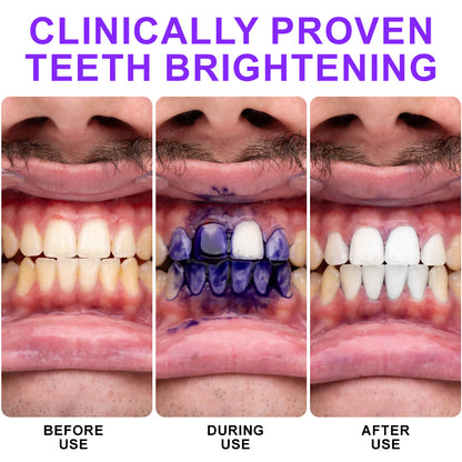 💚💚𝐅𝐥𝐲𝐬𝐦𝐮𝐬®🦷 𝐂𝐨𝐥𝐨𝐮𝐫 𝐂𝐨𝐫𝐫𝐞𝐜𝐭𝐨𝐫 𝐒𝐞𝐫𝐮𝐦 — Clinically proven to gently remove stains, whiten teeth, and restore natural brightness in just 3 days — safe for sensitive teeth and enamel