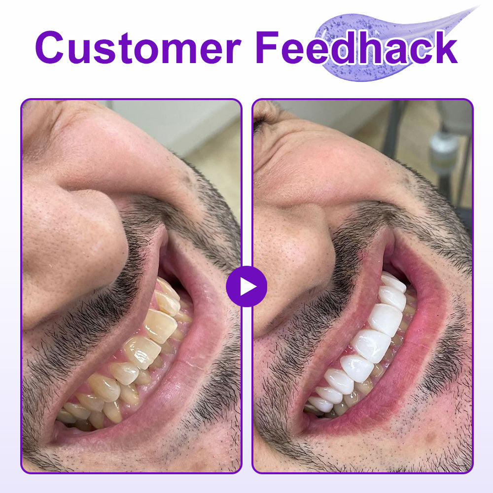 🦷𝐙𝐯𝐨𝐞𝐯𝐨® 𝐍𝐞𝐰𝟕-𝐏𝐫𝐨𝐈𝐧𝐭𝐞𝐧𝐬𝐢𝐯𝐞 𝐓𝐨𝐨𝐭𝐡𝐩𝐚𝐬𝐭𝐞 — Clinically proven to gently remove stains, whiten teeth, and restore natural brightness in just 3 days — safe for sensitive teeth and enamel