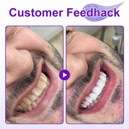 🦷𝐙𝐯𝐨𝐞𝐯𝐨® 𝐍𝐞𝐰𝟕-𝐏𝐫𝐨𝐈𝐧𝐭𝐞𝐧𝐬𝐢𝐯𝐞 𝐓𝐨𝐨𝐭𝐡𝐩𝐚𝐬𝐭𝐞 — Clinically proven to gently remove stains, whiten teeth, and restore natural brightness in just 3 days — safe for sensitive teeth and enamel