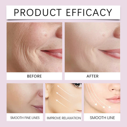 ✨ V-Face Lifting Tape🪄– Instant Jawline Lift & Slim Look