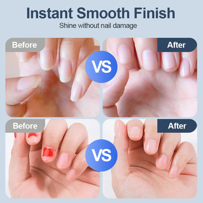 🆙✨ Universal Automatic Fingernail Grinder - 6 Speed Settings with 5 Attachments for Safe & Gentle Nail Care 👶🔧